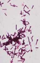 Tetanus bacteria